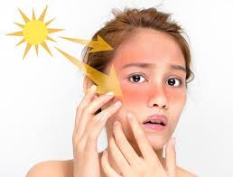 Tránh Tiếp Xúc Với Ánh Nắng Mặt Trời